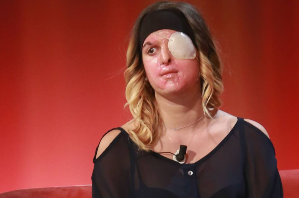 "Tu con l'uncino, io con la benda": la forza di Gessica Notaro e Valentina Pitzalis