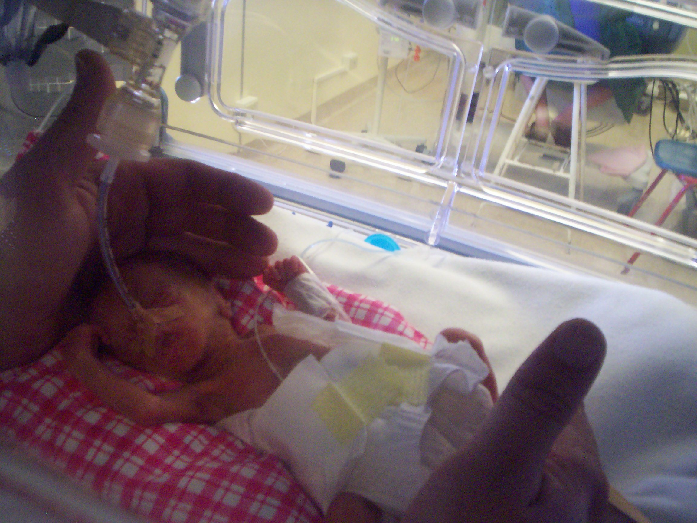 Nascere due volte: Cristina e la doppia nascita dei bambini prematuri