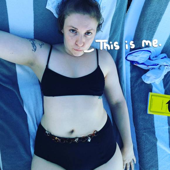Lena Dunham: "Trovarsi calva per una malattia autoimmune"