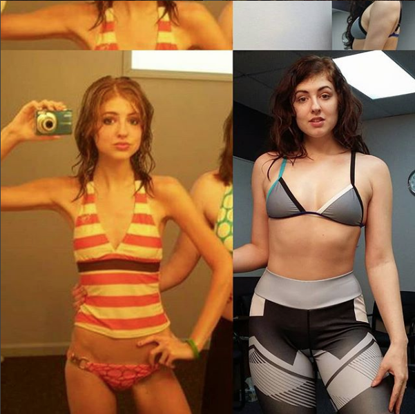 Rinascere: 12 foto prima e dopo l'anoressia