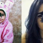 "Non la tolgo, perché questa "macchia" mi rende bellissima ed è parte di me"