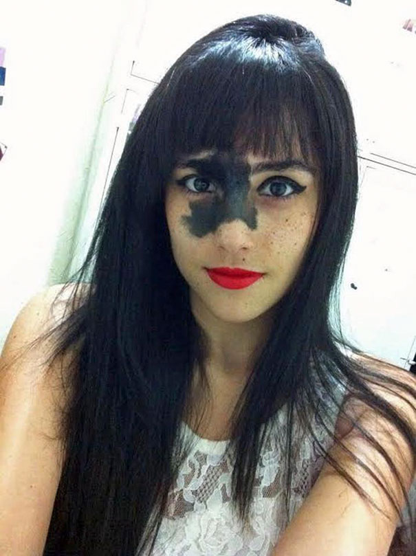 "Non la tolgo, perché questa "macchia" mi rende bellissima ed è parte di me"