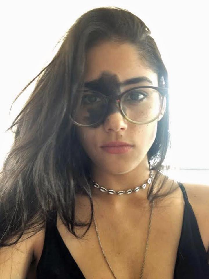 "Non la tolgo, perché questa "macchia" mi rende bellissima ed è parte di me"