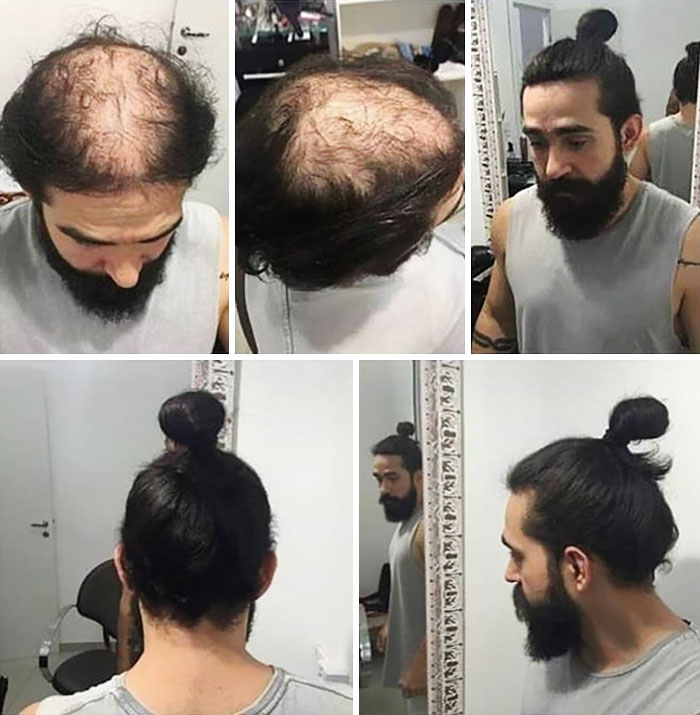 Chignon maschile: 5 immagini ci mostrano che a volte... nasconde qualcosa