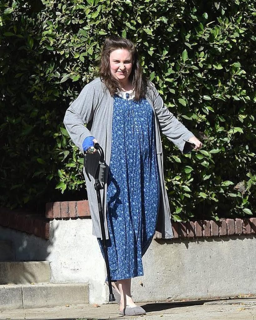 Lena Dunham: "Trovarsi calva per una malattia autoimmune"