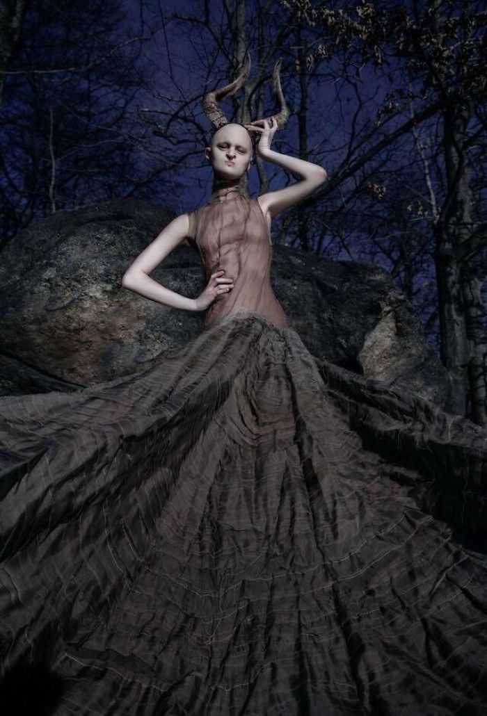 Melanie, top model nonostante la sua rara malattia genetica
