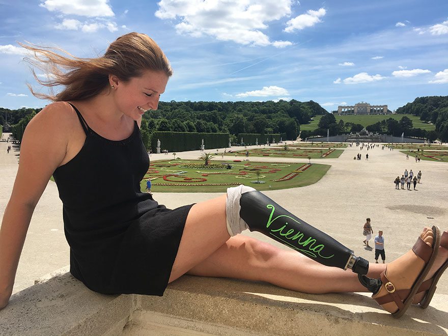 Il giro del mondo di questa ragazza con una protesi alla gamba