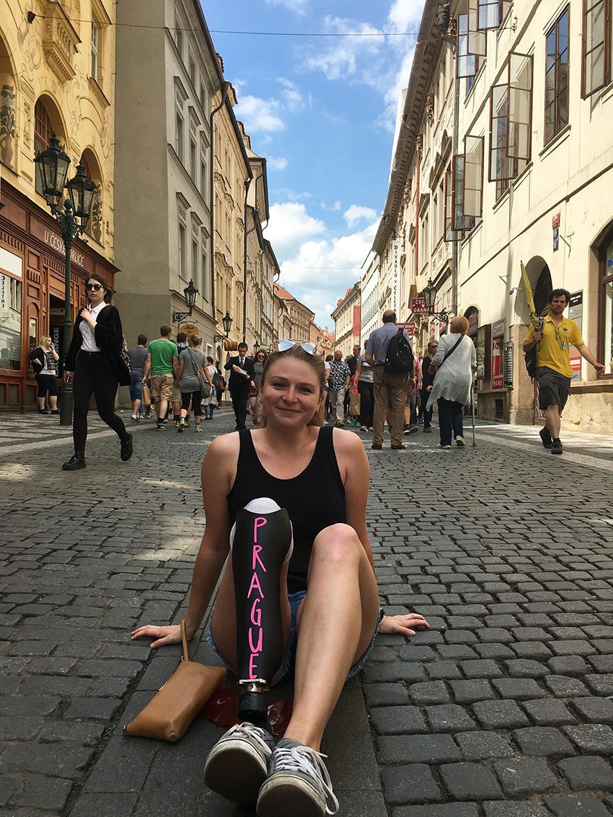 Il giro del mondo di questa ragazza con una protesi alla gamba