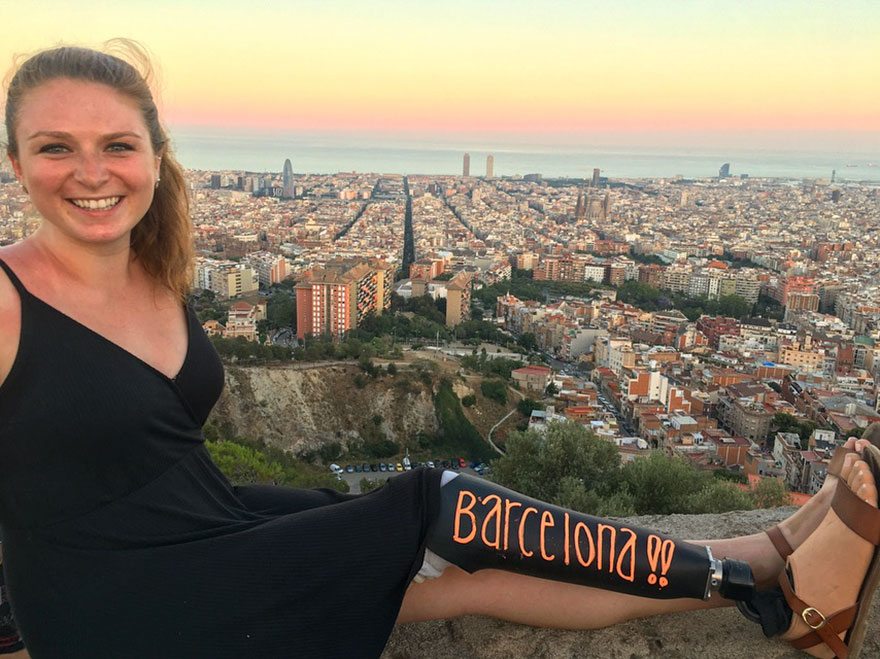 Il giro del mondo di questa ragazza con una protesi alla gamba