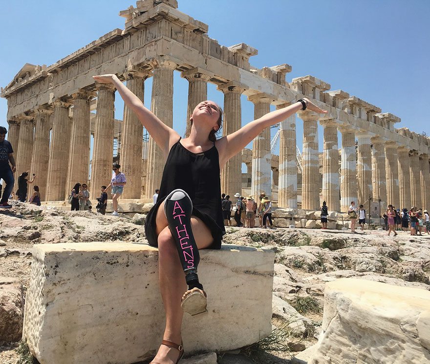 Il giro del mondo di questa ragazza con una protesi alla gamba