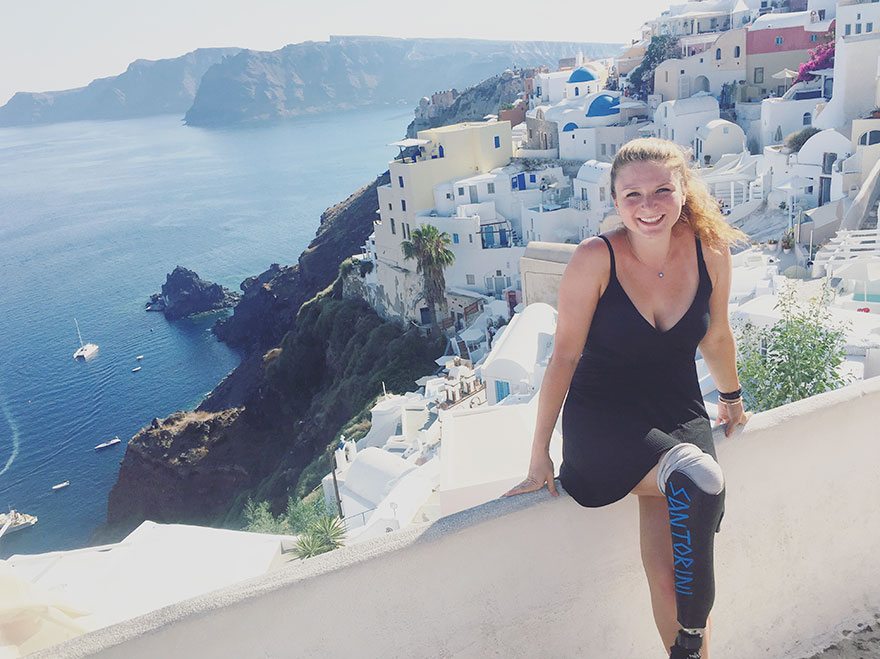 Il giro del mondo di questa ragazza con una protesi alla gamba