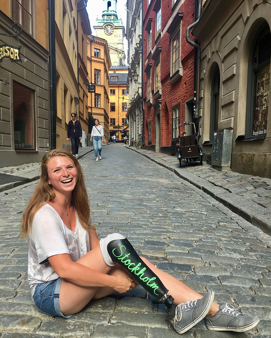 Il giro del mondo di questa ragazza con una protesi alla gamba