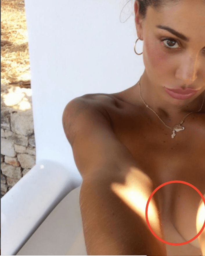 Belen, piedi e mano deformati: il "mistero" delle vacanze. O è Photoshop?