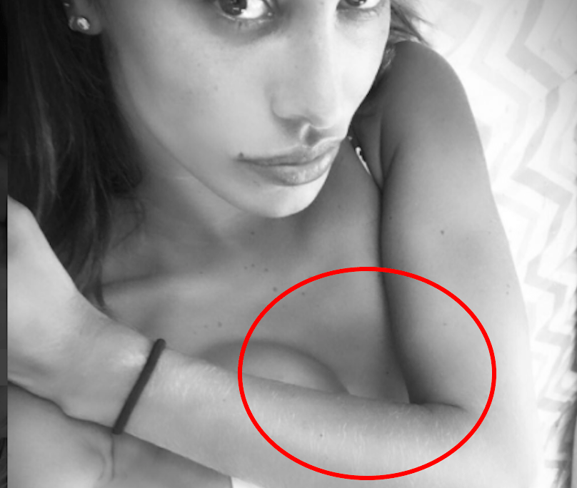 Belen, piedi e mano deformati: il "mistero" delle vacanze. O è Photoshop?