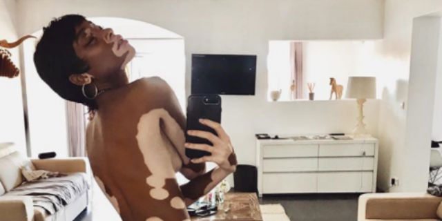 Winnie Harlow: "Celebrate l'unicità della vostra bellezza ogni giorno" Winnie Harlow: "Celebrate l'unicità della vostra bellezza ogni giorno"