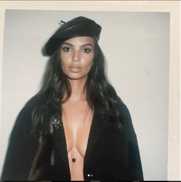 "Basta Photoshop", Emily, Kate e le altre star che si sono arrabbiate con le riviste