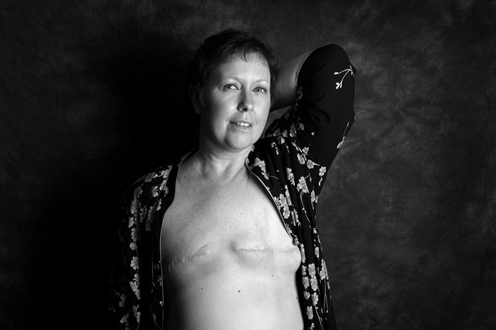 "Mastectomy": "Siamo vive, belle e forti anche senza un pezzo"
