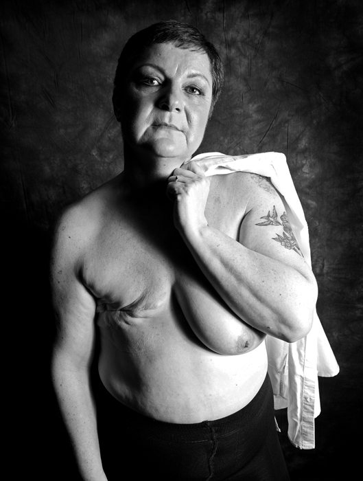 "Mastectomy": "Siamo vive, belle e forti anche senza un pezzo"
