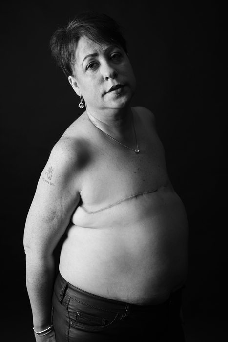 "Mastectomy": "Siamo vive, belle e forti anche senza un pezzo"