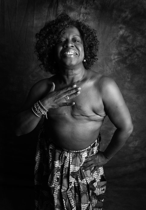 "Mastectomy": "Siamo vive, belle e forti anche senza un pezzo"