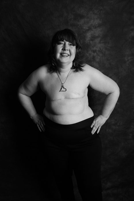 "Mastectomy": "Siamo vive, belle e forti anche senza un pezzo"