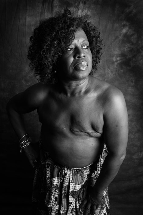 "Mastectomy": "Siamo vive, belle e forti anche senza un pezzo"
