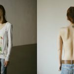 "Voglio sparire": il dramma dei disturbi alimentari in 11 foto