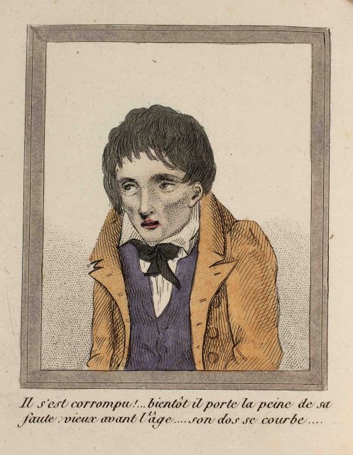 La morte per masturbazione in 16 illustrazioni dell'Ottocento