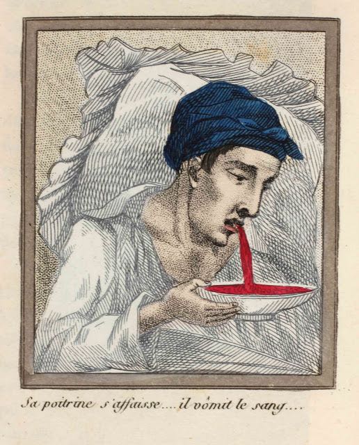 La morte per masturbazione in 16 illustrazioni dell'Ottocento