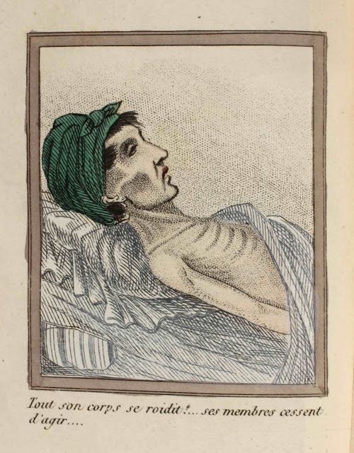 La morte per masturbazione in 16 illustrazioni dell'Ottocento