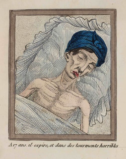 La morte per masturbazione in 16 illustrazioni dell'Ottocento