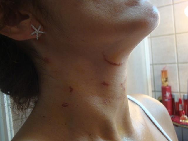Lidia Vivoli: "Vi mostro il mio corpo dilaniato da chi mi chiamava 'amore'"
