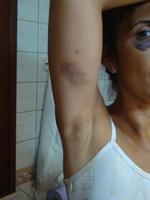 Lidia Vivoli: "Vi mostro il mio corpo dilaniato da chi mi chiamava 'amore'"