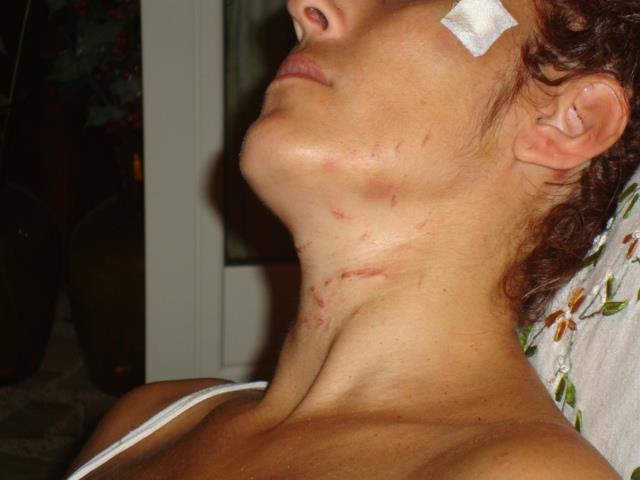 Lidia Vivoli: "Vi mostro il mio corpo dilaniato da chi mi chiamava 'amore'"
