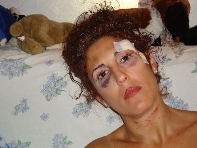 Lidia Vivoli: "Vi mostro il mio corpo dilaniato da chi mi chiamava 'amore'"