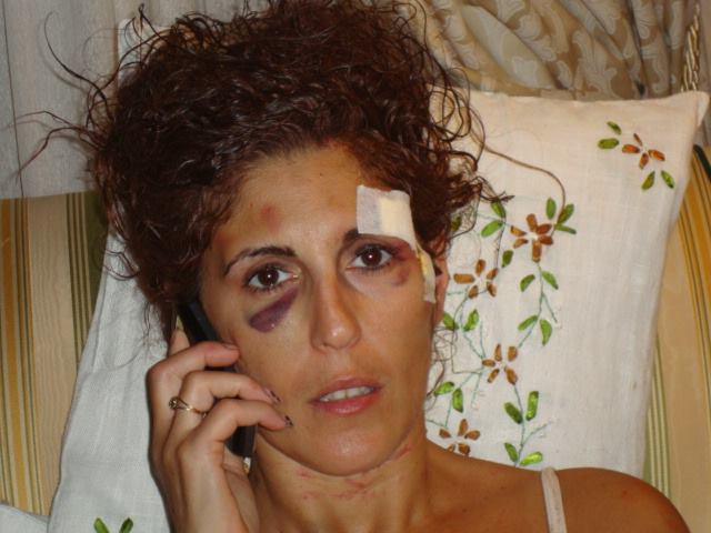 Lidia Vivoli: "Vi mostro il mio corpo dilaniato da chi mi chiamava 'amore'"