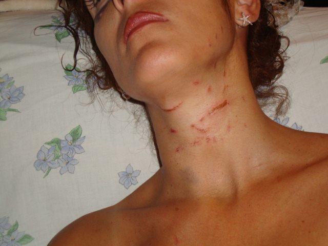 Lidia Vivoli: "Vi mostro il mio corpo dilaniato da chi mi chiamava 'amore'"
