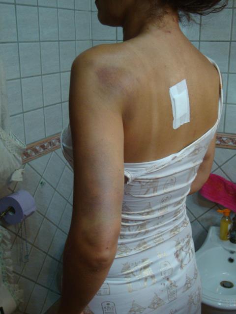 Lidia Vivoli: "Vi mostro il mio corpo dilaniato da chi mi chiamava 'amore'"