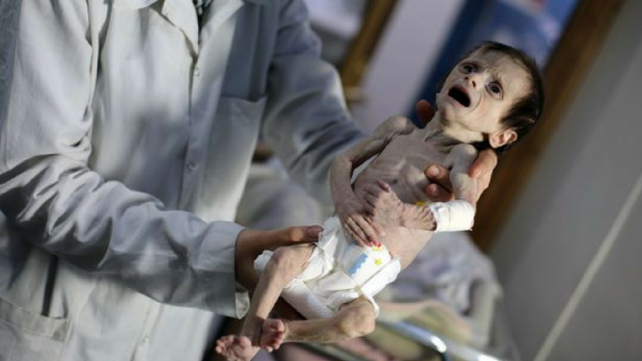 Bambini in guerra: alcuni tentano il suicidio, 1 su 4 ha problemi di salute mentale