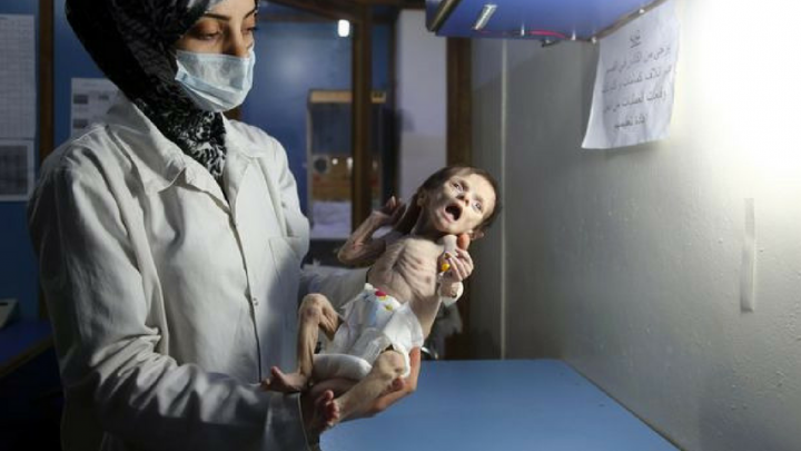 Bambini in guerra: alcuni tentano il suicidio, 1 su 4 ha problemi di salute mentale