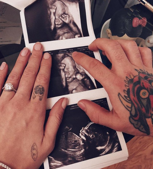 Ferragni e Fedez, baby raviolo in arrivo