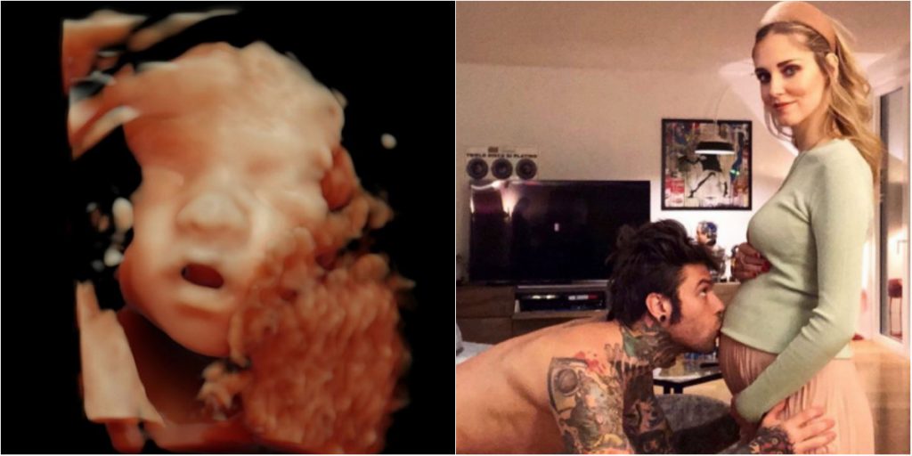Ferragni e Fedez, baby raviolo in arrivo