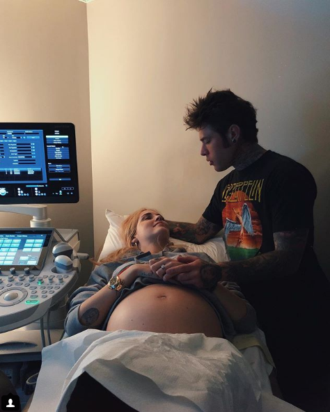 Ferragni e Fedez, baby raviolo in arrivo