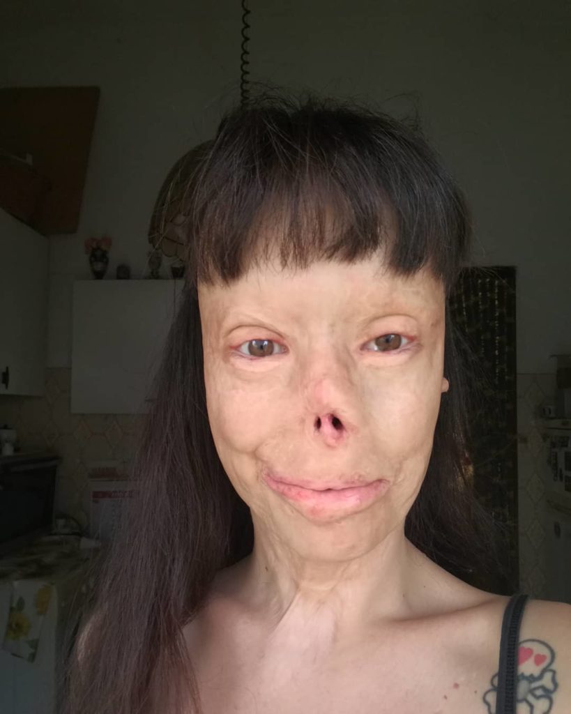 "Tu con l'uncino, io con la benda": la forza di Gessica Notaro e Valentina Pitzalis