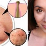 Come fare una maschera purificante per punti neri fai-da-te