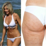 5 Fantastici Scrub anti cellulite fai da te: ricette e consigli!