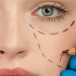 Lipofilling viso e corpo: cos'è, come funziona e i prezzi