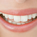 Sbiancamento denti: tecniche e prezzi