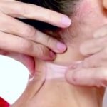 Lifting low cost con lo scotch: trend virali da non imitare