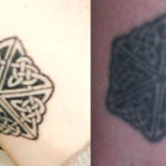 Anche i tattoo invecchiano: guida alla cura del tatuaggio